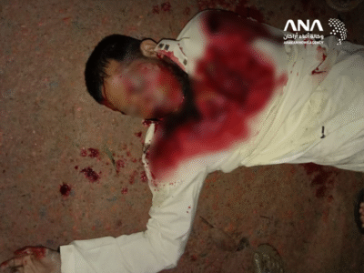 Dead body of the Rohingya victim (Image: ANA)