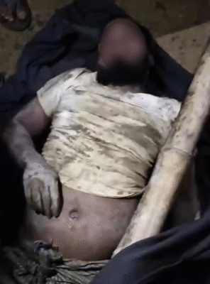 One of the rescued Rohingya refugees before being moved to hospital (Image: Social Media) 